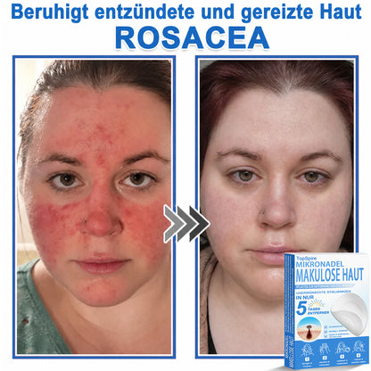 🎁🎁🎁 Erhalten Sie 30 % Rabatt auf das zweite Produkt!