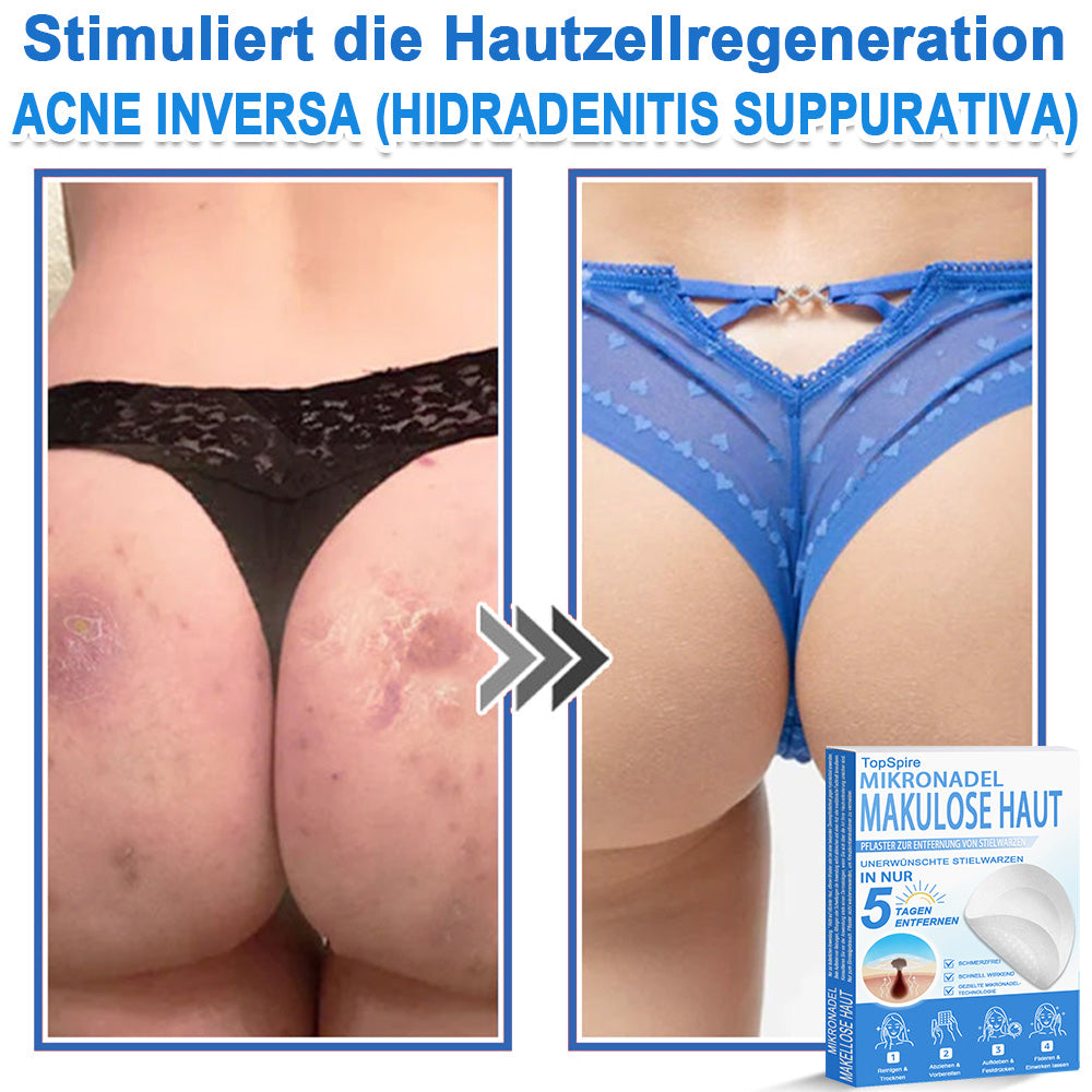 🎁🎁🎁 Erhalten Sie 30 % Rabatt auf das zweite Produkt!
