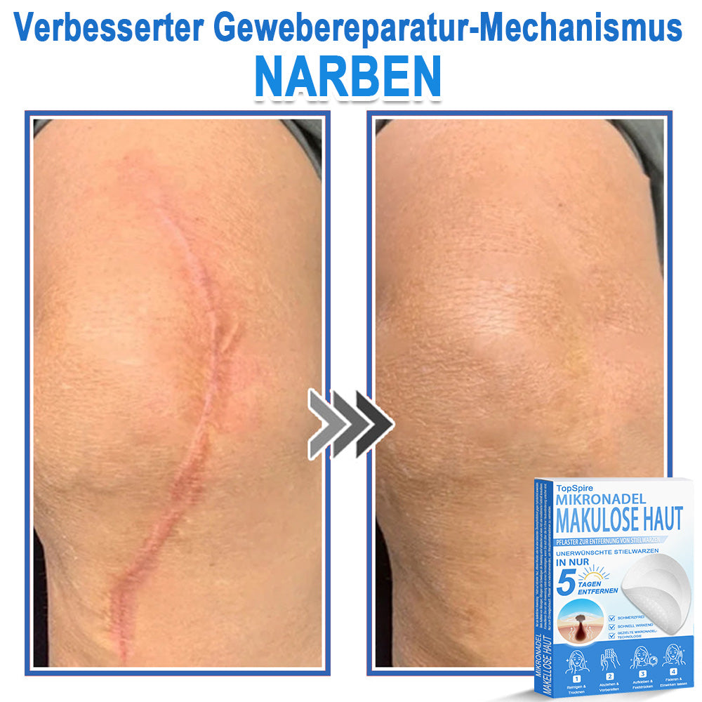 🎁🎁🎁 Erhalten Sie 30 % Rabatt auf das zweite Produkt!