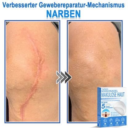 🎁🎁🎁 Erhalten Sie 30 % Rabatt auf das zweite Produkt!