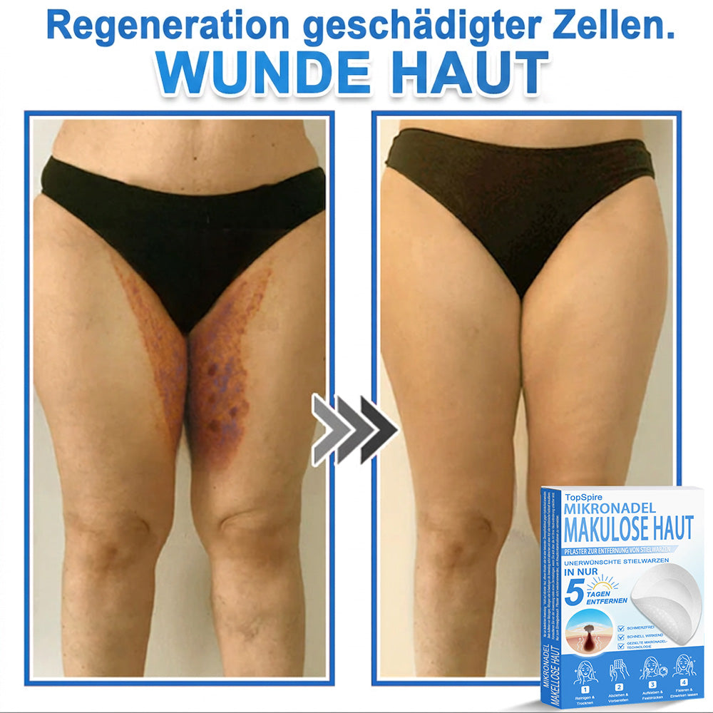 🎁🎁🎁 Erhalten Sie 30 % Rabatt auf das zweite Produkt!