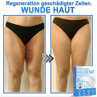 🎁🎁🎁 Erhalten Sie 30 % Rabatt auf das zweite Produkt!
