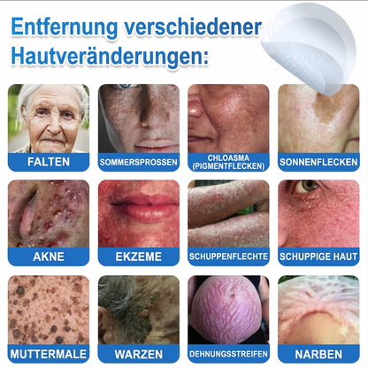 🎁🎁🎁 Erhalten Sie 30 % Rabatt auf das zweite Produkt!