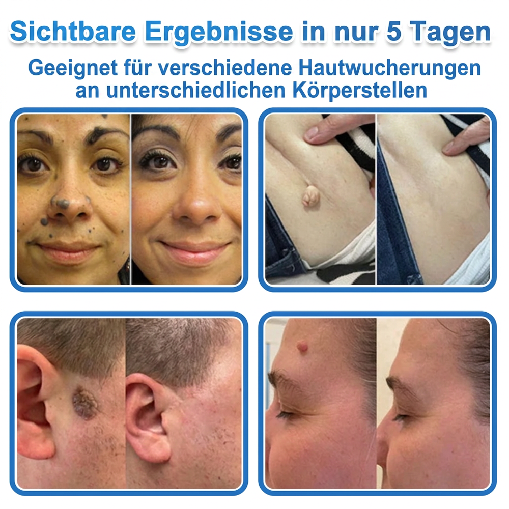 🎁🎁🎁 Erhalten Sie 30 % Rabatt auf das zweite Produkt!