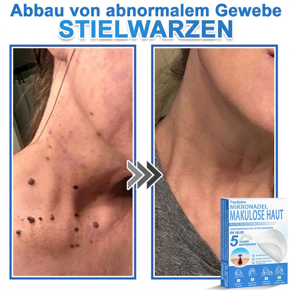 🎁🎁🎁 Erhalten Sie 30 % Rabatt auf das zweite Produkt!