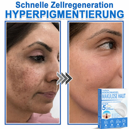 🎁🎁🎁 Erhalten Sie 30 % Rabatt auf das zweite Produkt!