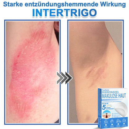 🎁🎁🎁 Erhalten Sie 30 % Rabatt auf das zweite Produkt!