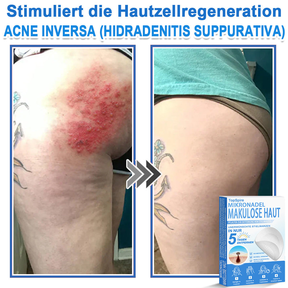 🎁🎁🎁 Erhalten Sie 30 % Rabatt auf das zweite Produkt!