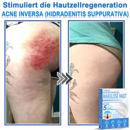 🎁🎁🎁 Erhalten Sie 30 % Rabatt auf das zweite Produkt!